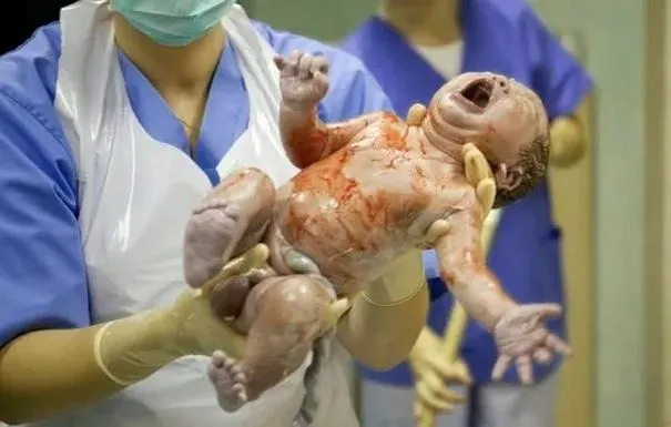 Ile kg traci się po porodzie? Oto, co warto wiedzieć o powrocie do formy