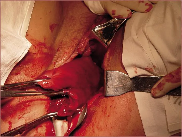 Jak radzić sobie z szyciem po porodzie – praktyczne porady dla młodych mam