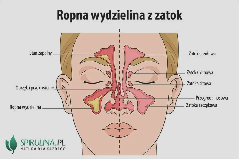 Ropna wydzielina z pochwy po porodzie – co powinny wiedzieć świeżo upieczone mamy?