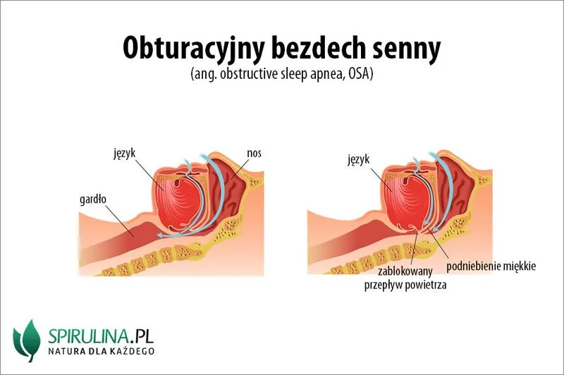 Diagnostyka bezdechu dziecięcego