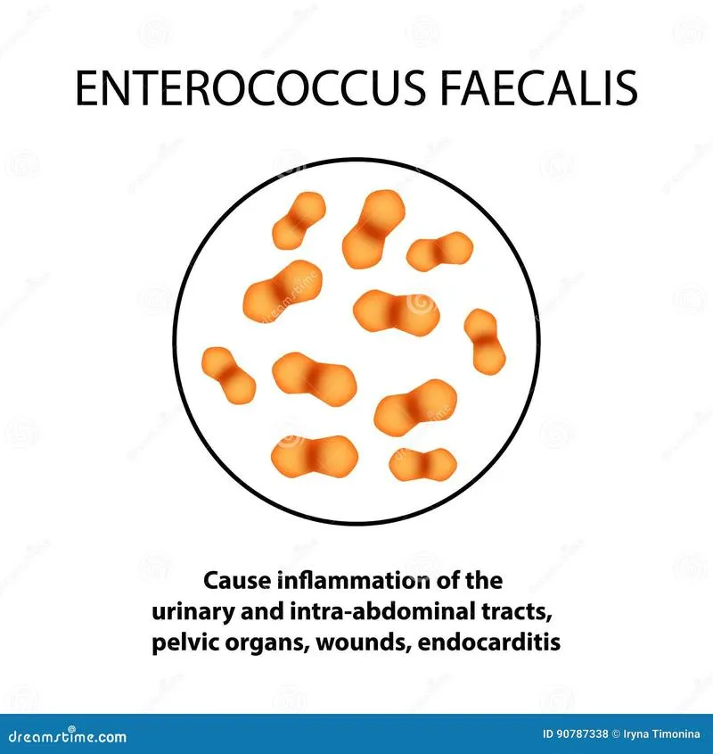 Enterococcus faecalis w ciąży