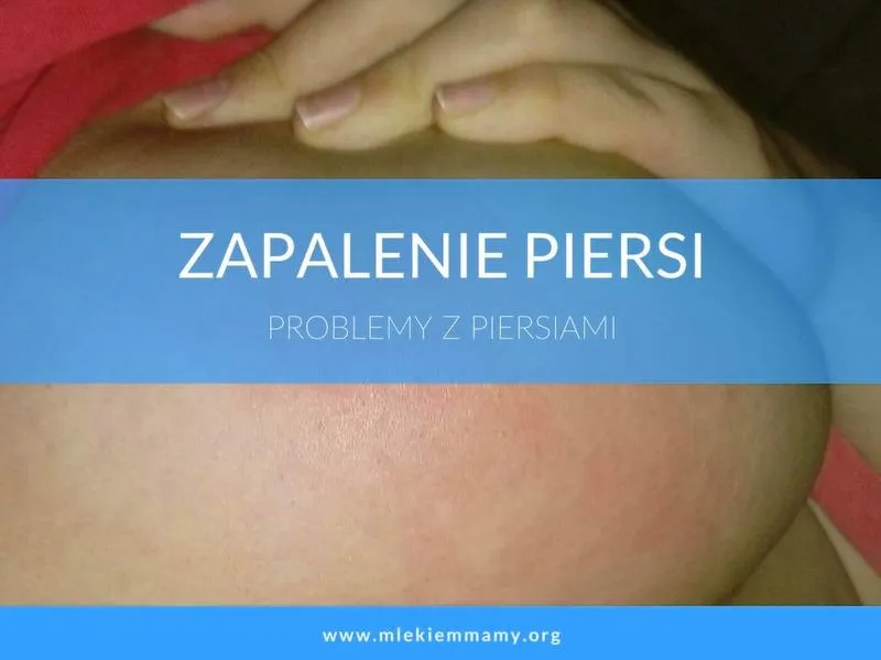 Karmienie piersią