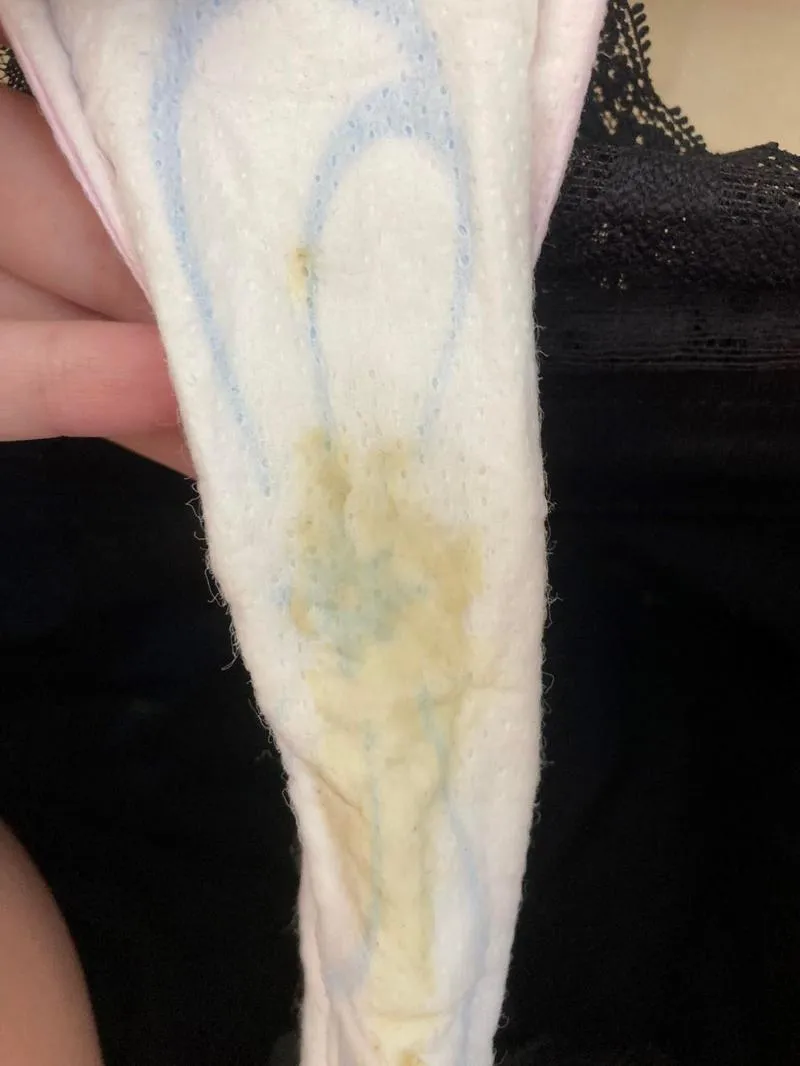 Kiedy do lekarza po porodzie