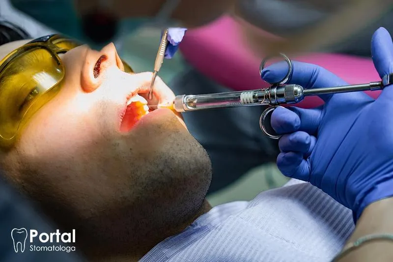 Metody znieczulenia dla mam