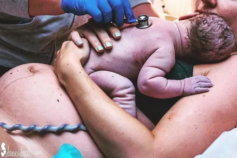 Objawy niedotlenienia noworodka