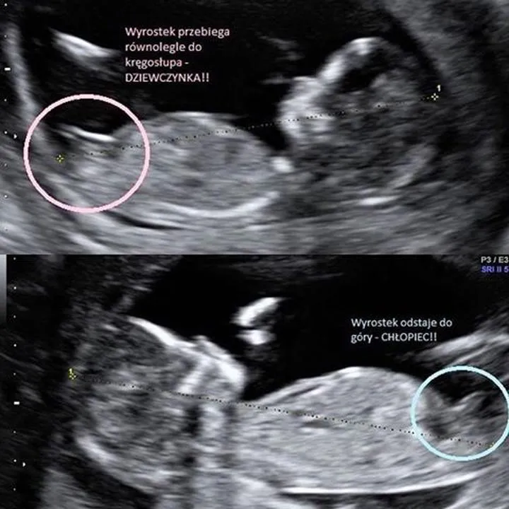 Rola chromosomów w płci