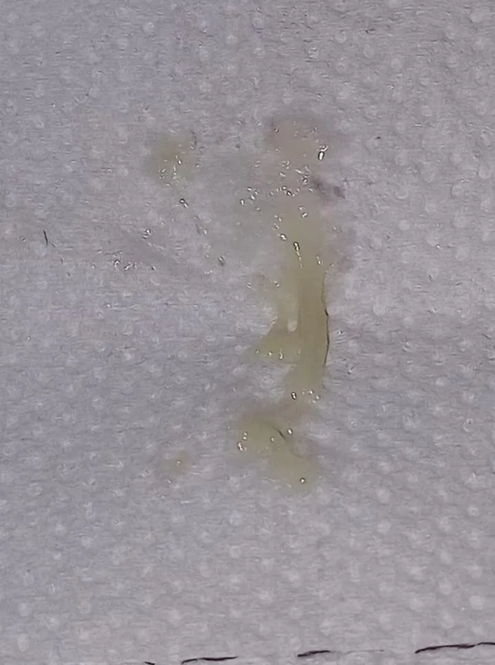 Zmiany hormonalne w ciąży